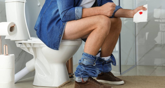 Anal Fissure Symptoms Anal Fissure Symptoms